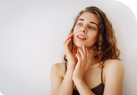 Scar Revision 113 quick recovery