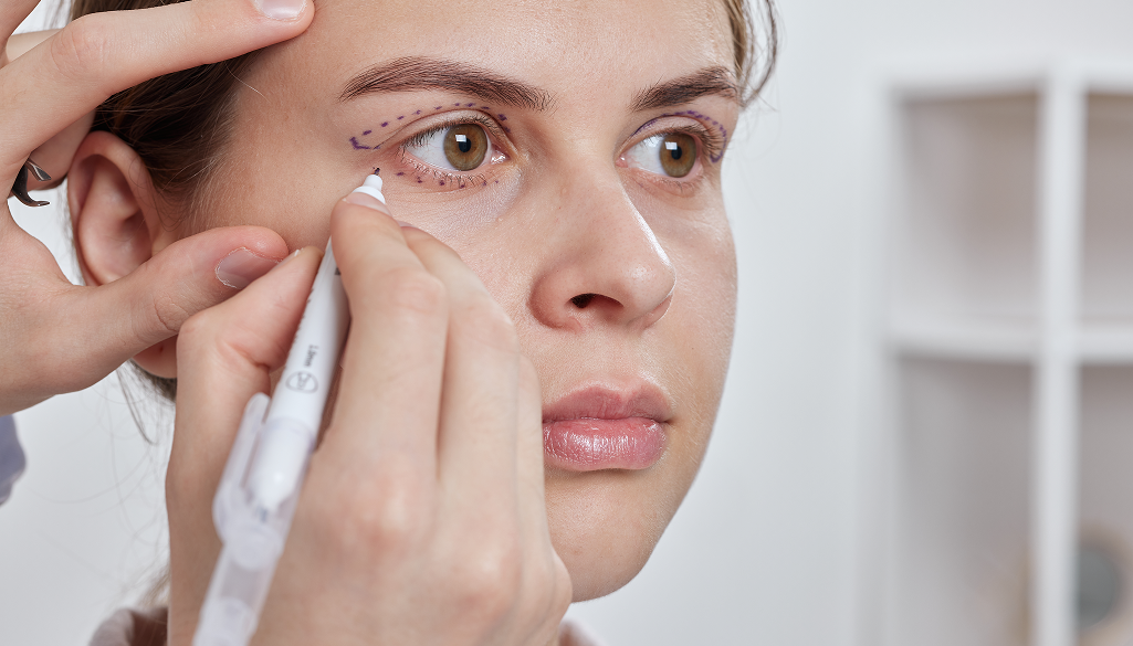 Blepharoplasty Scars: Everything You Need To Know