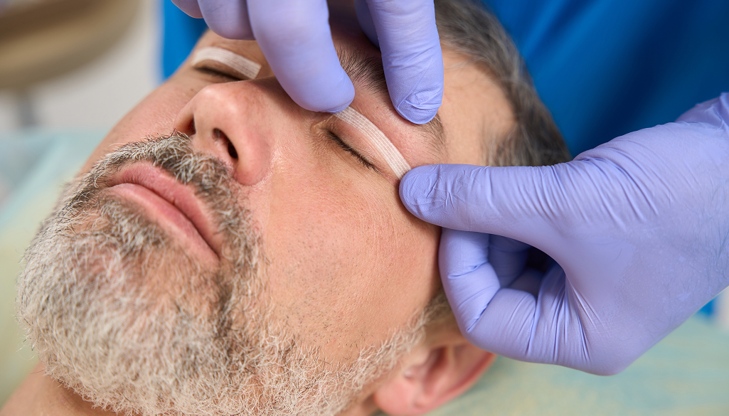 Recovery for Blepharoplasty: What to Expect and How to Heal Faster