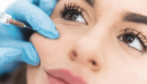 Cheek filler swelling stages