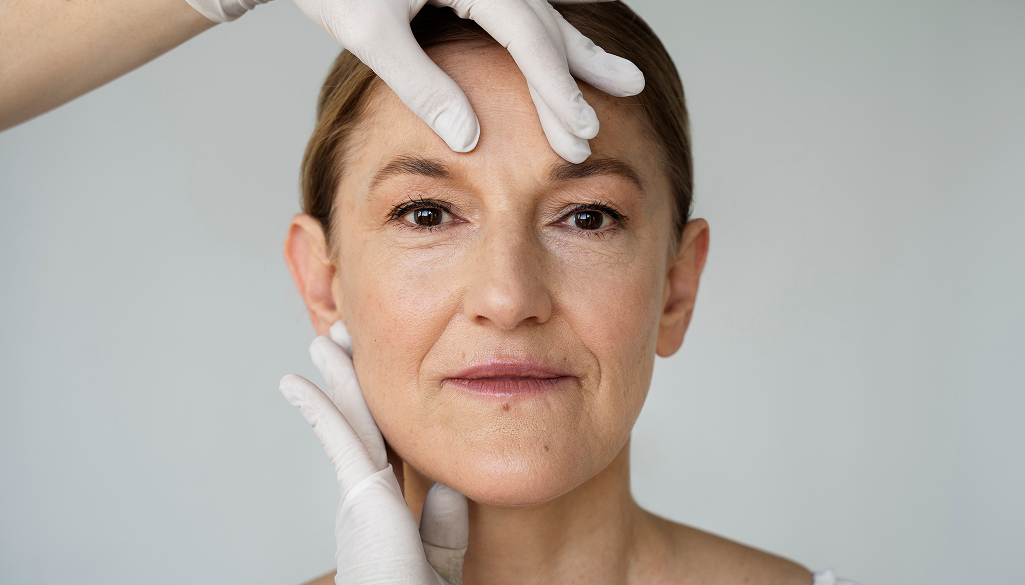 How to get rid of marionette lines