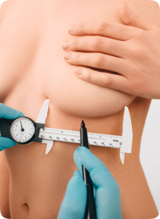 Breast Augmentation (BBA) 140 Breast Augmentation2
