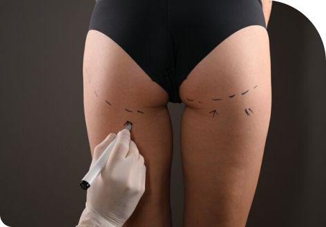 Reduced Sagging Skin1