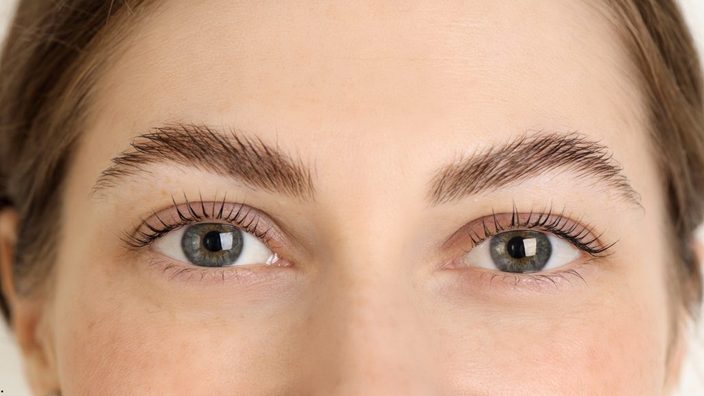 How Long Does a Brow Lift Last? Results, Recovery & Expectations
