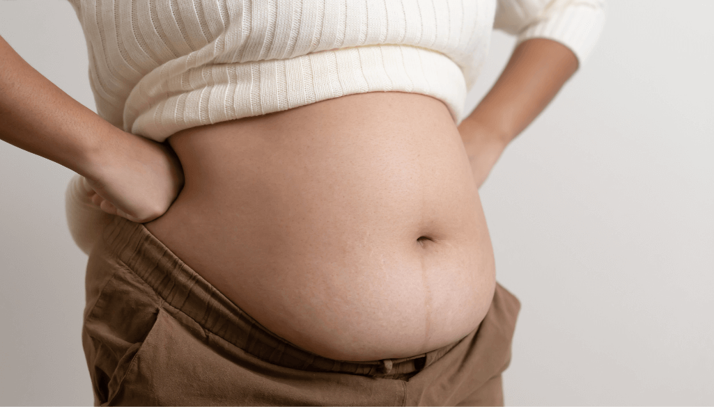 What is Apron Belly & How to get Rid of It?