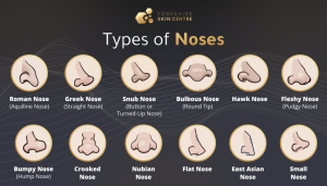 Different Types of noses
