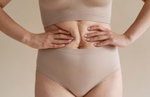 Woman showing loose skin around menopause belly area in nude shapewear