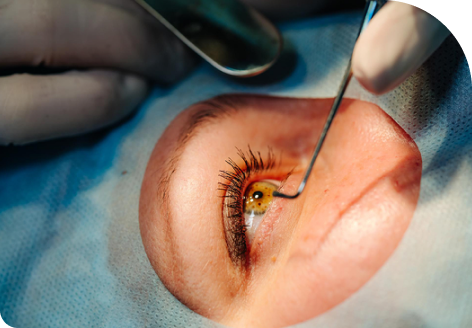 lower infection risk