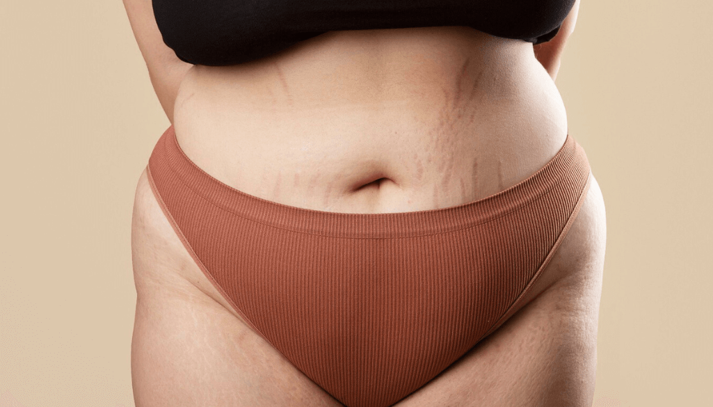 What is a FUPA & How to Get Rid of It?