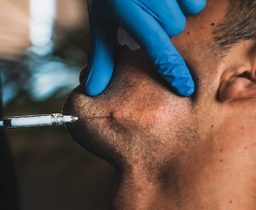 Dermal Fillers Treatment for Men in Leeds