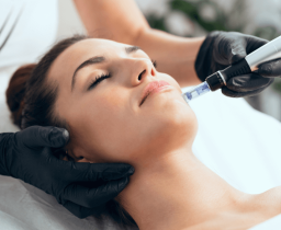 Morpheus8 treatment for uneven skin tone