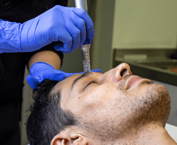 SkinPen Microneeding Treatment in Leeds​